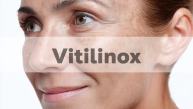 Vitilinox